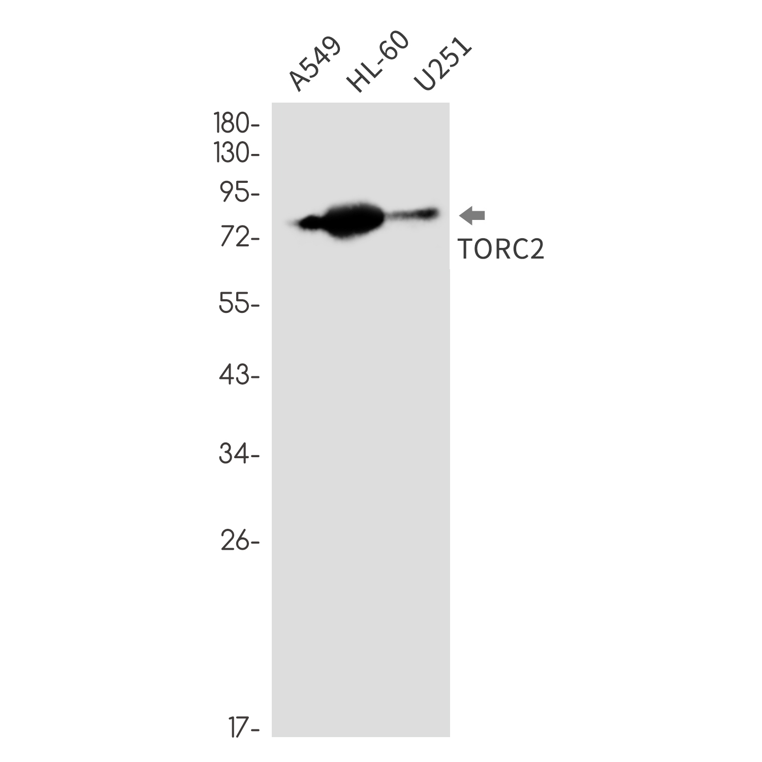 CREB Regulated Transcription Coactivator 2 Rabbit mAb